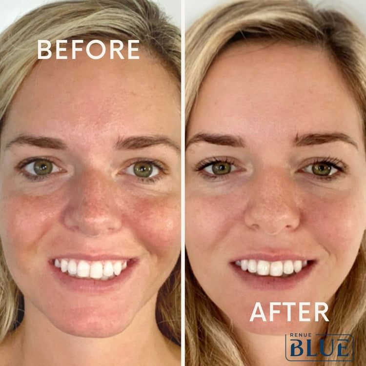 Face Cream Renue Blue
