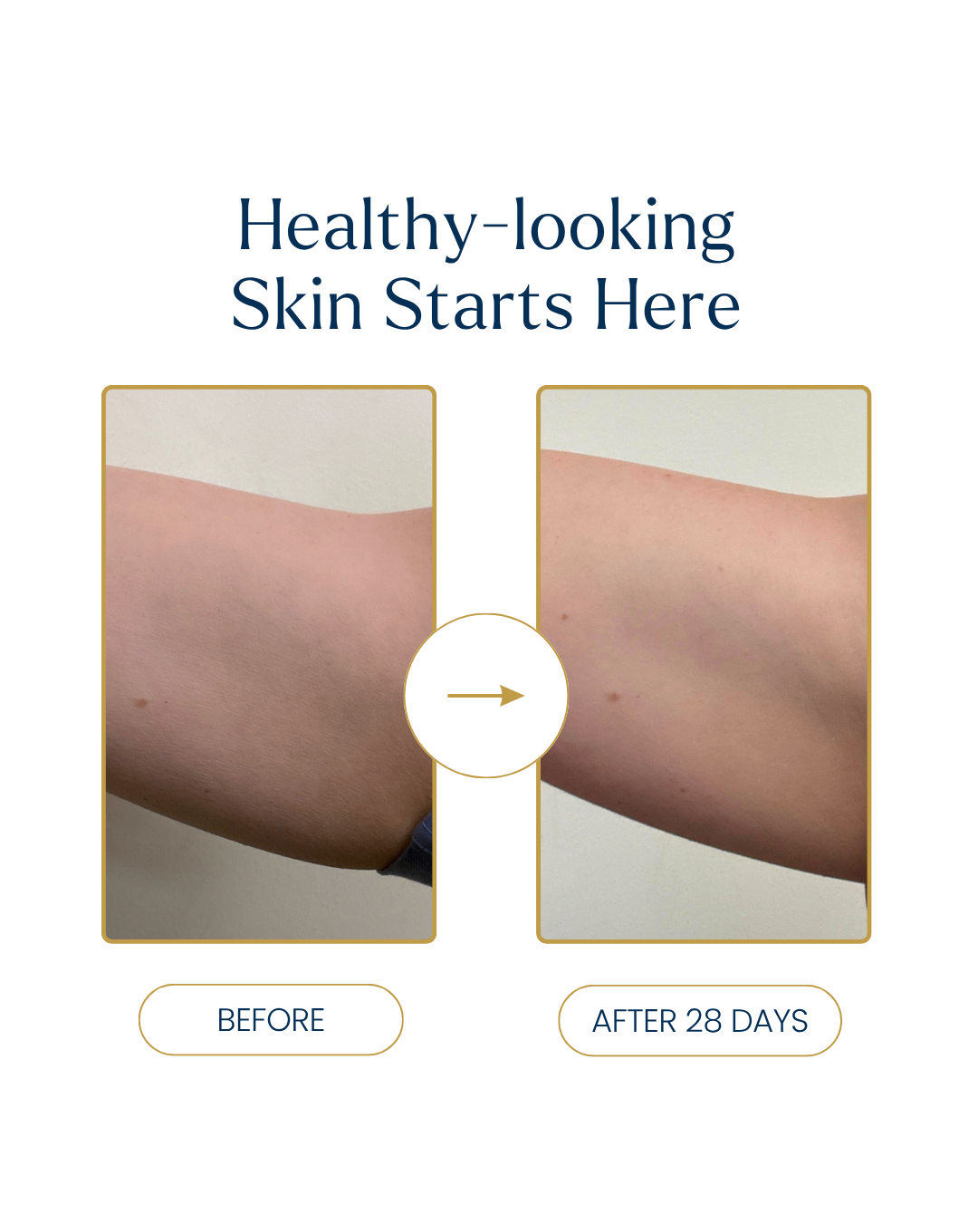 Before and after skin comparison showing a forearm, with the headline 'Healthy-looking Skin Starts Here' and labels 'BEFORE' and 'AFTER 28 DAYS'.
